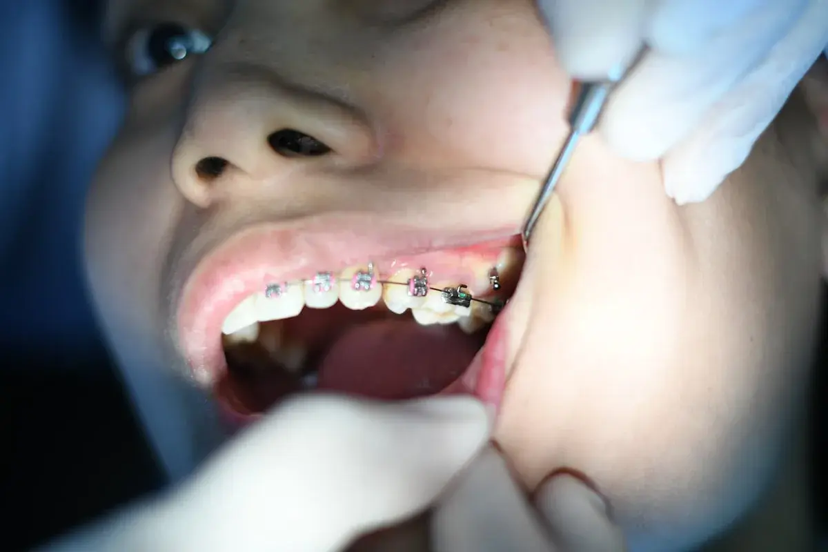 Dental braces closeup