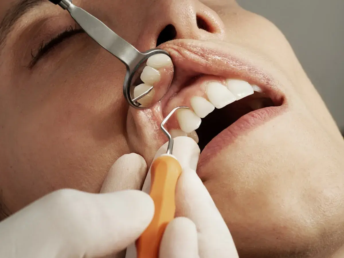 Professional whitening technology